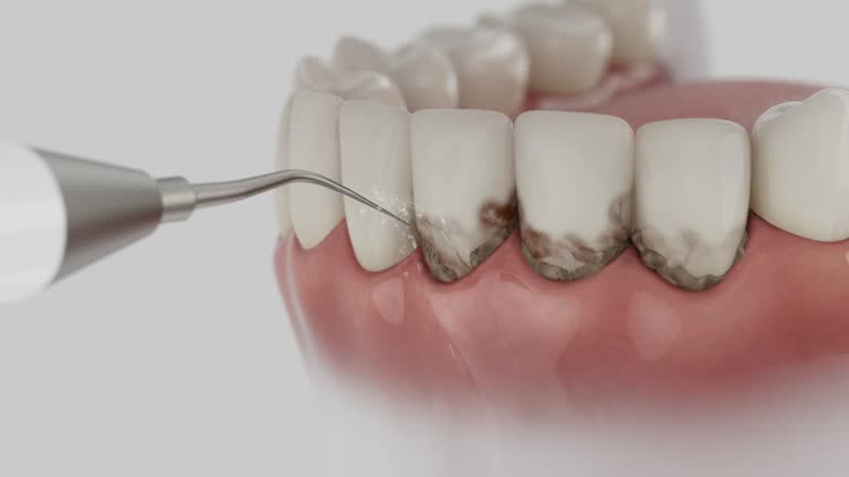 Reliable Dental contractor in Atlanta, TX by Smile Center Dentistry